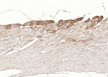 DLST Rabbit Polyclonal Antibody
