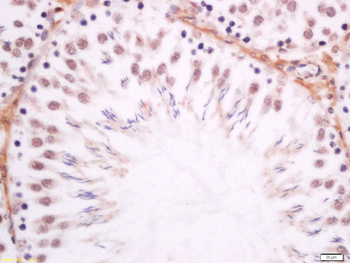 Dmrta1 Rabbit Polyclonal Antibody