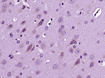 Dscam Rabbit Polyclonal Antibody