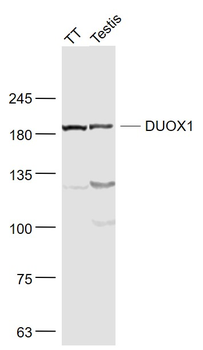 DUOX1 Rabbit Polyclonal Antibody