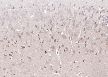 DUSP10 Rabbit Polyclonal Antibody