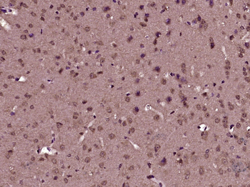 DUSP10 Rabbit Polyclonal Antibody