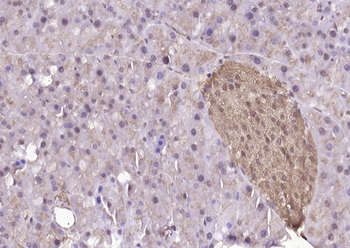 DUSP10 Rabbit Polyclonal Antibody