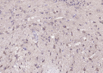 DUSP10 Rabbit Polyclonal Antibody
