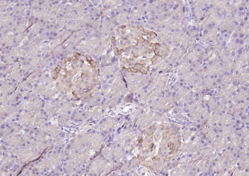 DUSP10 Rabbit Polyclonal Antibody