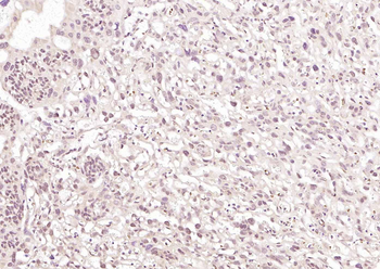 DUSP5 Rabbit Polyclonal Antibody