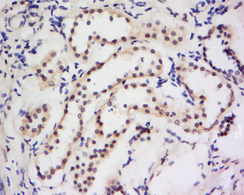 Dymeclin Rabbit Polyclonal Antibody