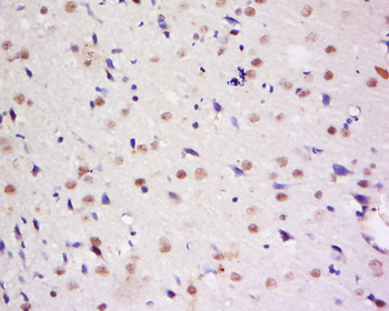 Dymeclin Rabbit Polyclonal Antibody