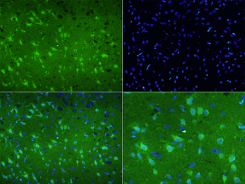 DYNC1I1 Rabbit Polyclonal Antibody
