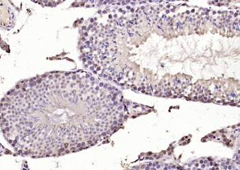 DYRK2 Rabbit Polyclonal Antibody