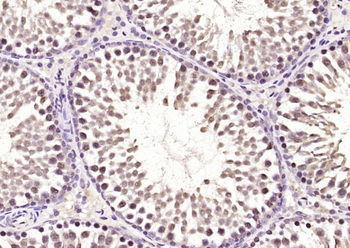 DYRK2 Rabbit Polyclonal Antibody