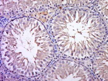 DZIP1 Rabbit Polyclonal Antibody