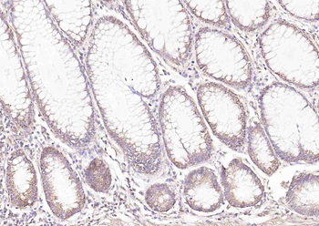 E cadherin Rabbit Polyclonal Antibody