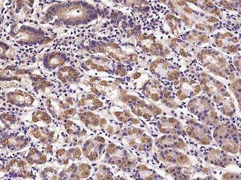 E cadherin Rabbit Polyclonal Antibody