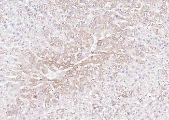 E cadherin Rabbit Polyclonal Antibody