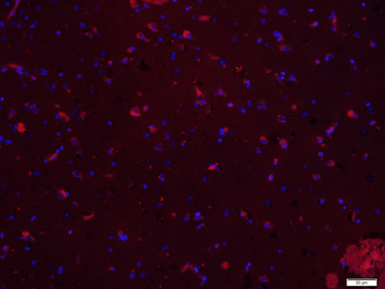 EGFR Rabbit Polyclonal Antibody