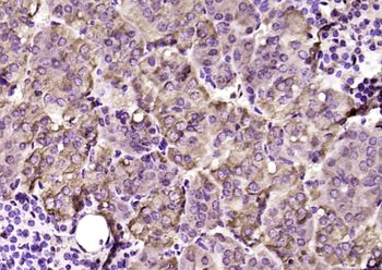 EPB41L4B Rabbit Polyclonal Antibody