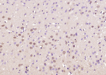 ELAVL4 Rabbit Polyclonal Antibody