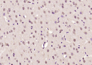 ELK4 Rabbit Polyclonal Antibody