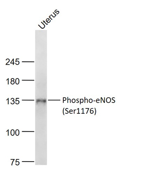 Phospho-eNOS (Ser1176) Rabbit Polyclonal Antibody