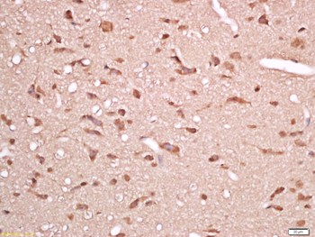 ENPP6 Rabbit Polyclonal Antibody