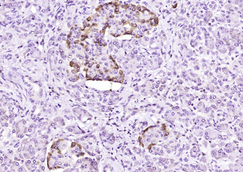 ENT1 Rabbit Polyclonal Antibody