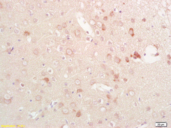 Phospho-Eph receptor B1 (Tyr928) Rabbit Polyclonal Antibody
