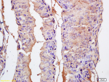 EPHA10 Rabbit Polyclonal Antibody