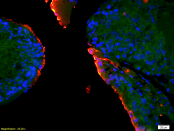 EPHA10 Rabbit Polyclonal Antibody