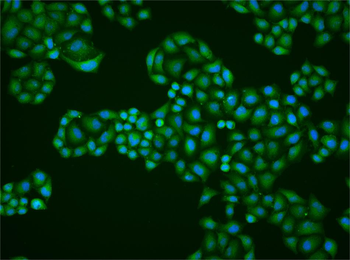 Epsin 1 Rabbit Polyclonal Antibody
