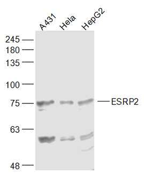ESRP2 Rabbit Polyclonal Antibody