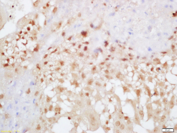 EXOC2 Rabbit Polyclonal Antibody