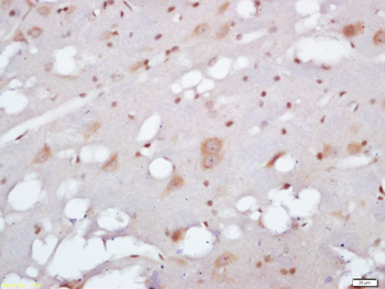 EXOC2 Rabbit Polyclonal Antibody