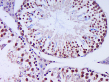 Exonuclease 1 Rabbit Polyclonal Antibody