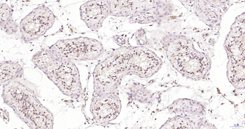 Exonuclease 1 Rabbit Polyclonal Antibody