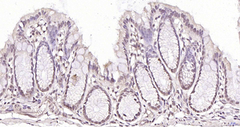 Exonuclease 1 Rabbit Polyclonal Antibody