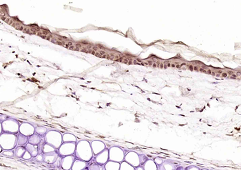 EXOSC10 Rabbit Polyclonal Antibody