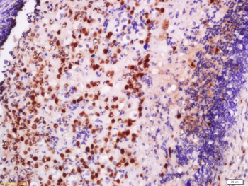 EXOSC10 Rabbit Polyclonal Antibody