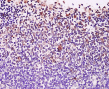 EXOSC10 Rabbit Polyclonal Antibody