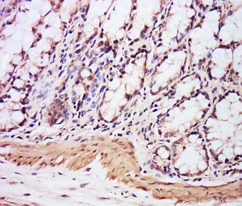 EXOSC7 Rabbit Polyclonal Antibody
