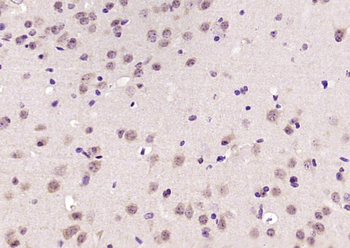 Exportin 5 Rabbit Polyclonal Antibody