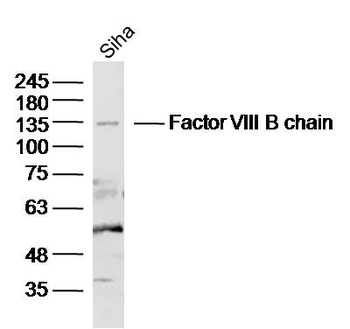 Factor VIII B chain antibody
