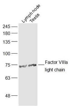 Factor VIIIa light chain Rabbit Polyclonal Antibody