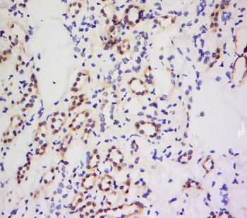 Factor XII light chain Rabbit Polyclonal Antibody