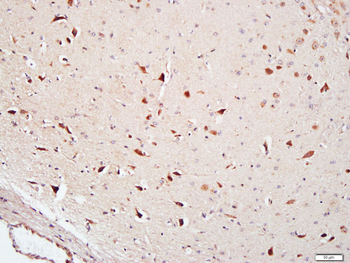 FAM134B Rabbit Polyclonal Antibody