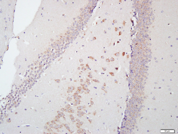FAM134B Rabbit Polyclonal Antibody