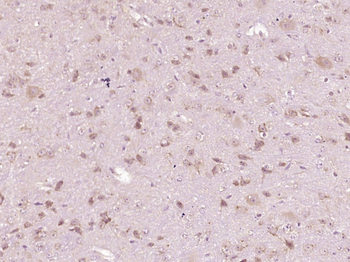FAM134B Rabbit Polyclonal Antibody