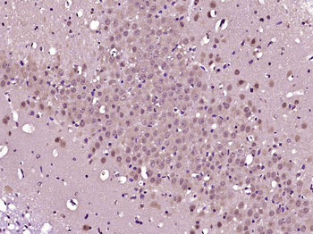FbxL4 Rabbit Polyclonal Antibody
