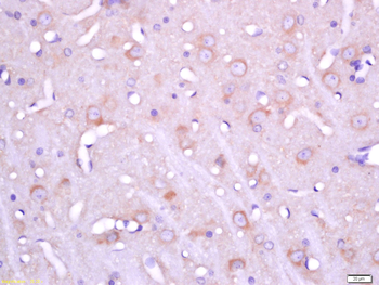 FHOD3 Rabbit Polyclonal Antibody