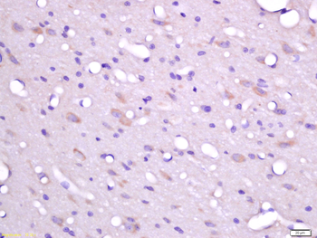 FHOD3 Rabbit Polyclonal Antibody